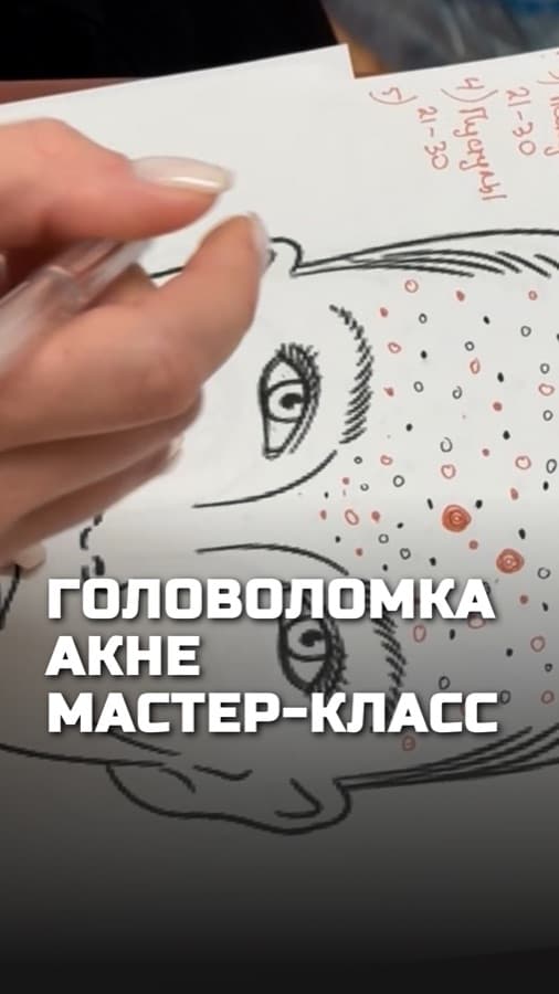 Обложка рилса: Акне — это головоломка